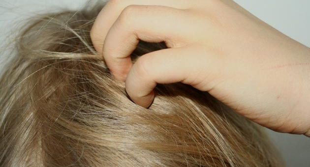 Benzina per i pidocchi | Grave una bambina