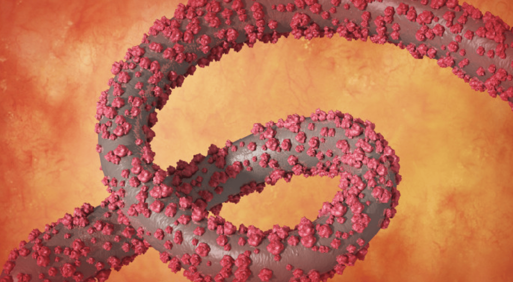 https://livesicilia.it/wp-content/uploads/2026/05/Ebola.png?w=1800